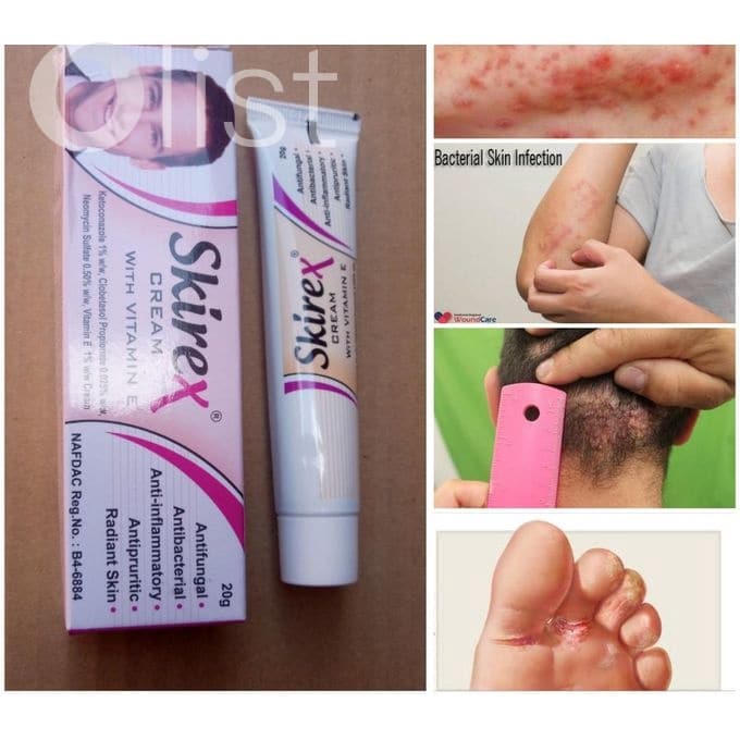 skirex cream 2680×680 Kevajo