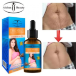 Aichun Beauty Huile essentielle naturel élimine les vergetures de grossesse 